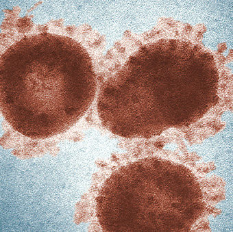 Prohlášení ohledně nových mimořádných opatření vlády ohledně nového typu koronaviru Covid-19